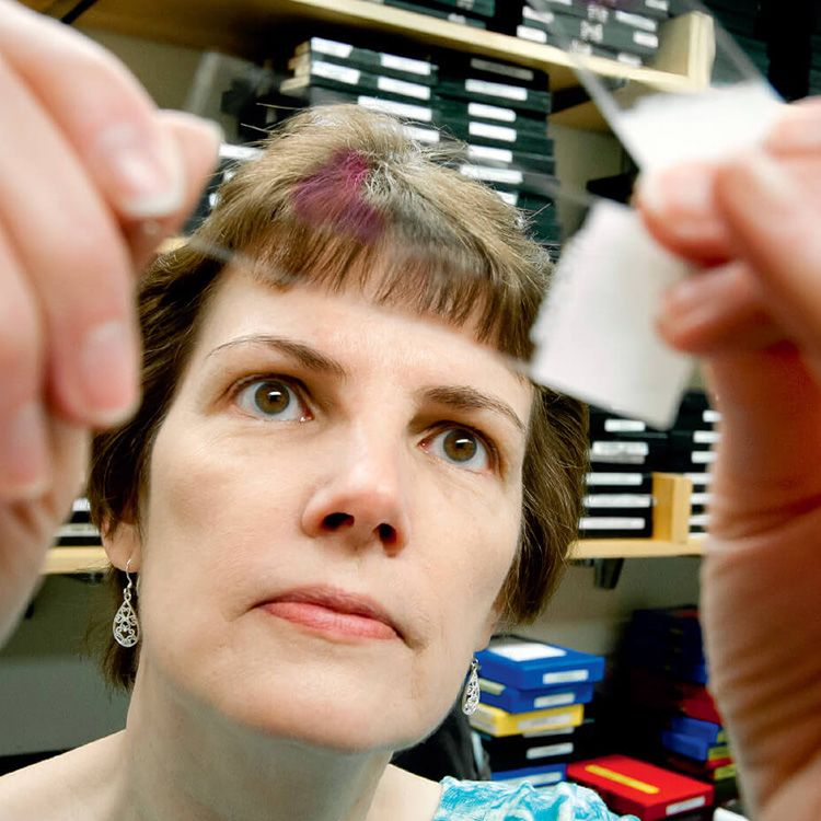Close up shot of a microscope slide being examined in the laboratory of Margie Clapper, PhD.