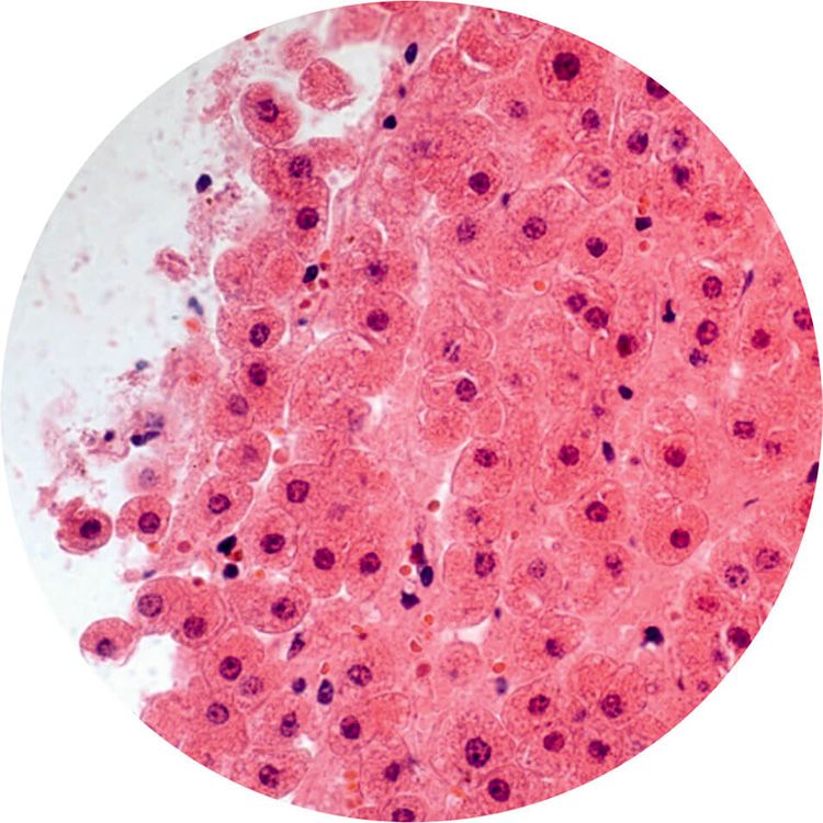 Microscopic image of liver cells.