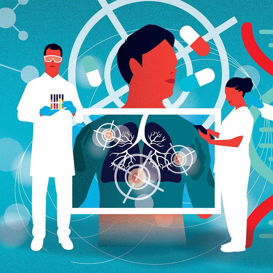 Illustration of medical staff observing a patient behind an X-ray screen that is detecting small cell lung cancer cells.